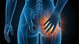 La sciatique est une douleur fesse osteo creon ambares